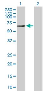 RIPK2 Antibody in Western Blot (WB)