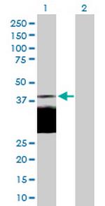 DLK1 Antibody in Western Blot (WB)