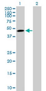 TNFRSF10B Antibody in Western Blot (WB)