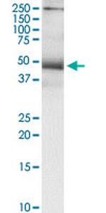 TNFRSF10B Antibody in Immunoprecipitation (IP)