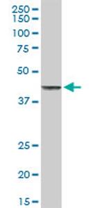 TNFRSF10B Antibody in Western Blot (WB)