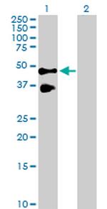 TNFRSF10B Antibody in Western Blot (WB)