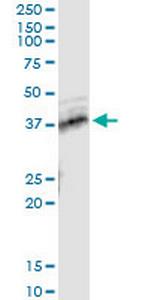 TNFRSF10B Antibody in Immunoprecipitation (IP)