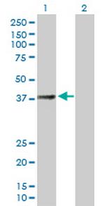 SUCLG2 Antibody in Western Blot (WB)