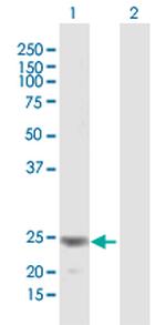 FGF18 Antibody in Western Blot (WB)