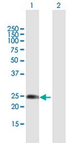 WISP2 Antibody in Western Blot (WB)