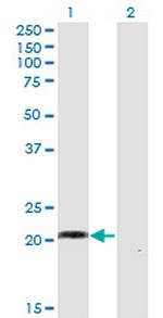 WISP2 Antibody in Western Blot (WB)