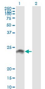 WISP2 Antibody in Western Blot (WB)