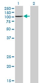 PCAF Antibody in Western Blot (WB)