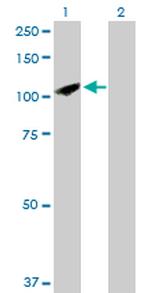 SYNJ2 Antibody in Western Blot (WB)