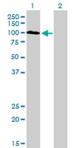 SYNJ2 Antibody in Western Blot (WB)