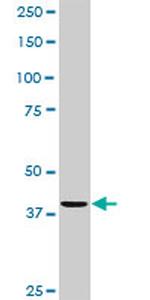 CDC123 Antibody in Western Blot (WB)