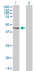 SPHK1 Antibody in Western Blot (WB)