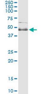 SPHK1 Antibody in Immunoprecipitation (IP)