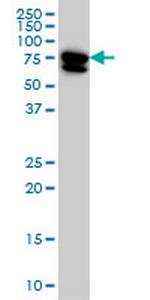 MTMR2 Antibody in Western Blot (WB)