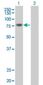 TOP3B Antibody in Western Blot (WB)