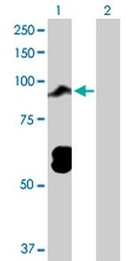 TOP3B Antibody in Western Blot (WB)