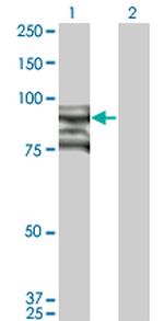 TOP3B Antibody in Western Blot (WB)