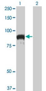 TOP3B Antibody in Western Blot (WB)