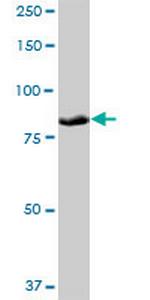 PLOD3 Antibody in Western Blot (WB)