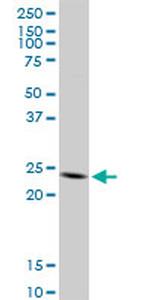 TNFSF18 Antibody in Western Blot (WB)