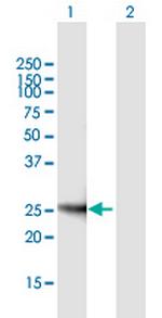 SOCS3 Antibody in Western Blot (WB)