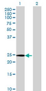 ARTN Antibody in Western Blot (WB)