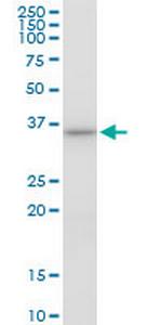 AIP Antibody in Western Blot (WB)