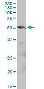 PIAS2 Antibody in Western Blot (WB)