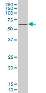 TBX18 Antibody in Western Blot (WB)