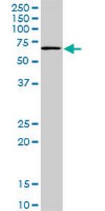 TBX18 Antibody in Western Blot (WB)