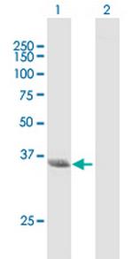 NMI Antibody in Western Blot (WB)