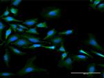 NMI Antibody in Immunocytochemistry (ICC/IF)