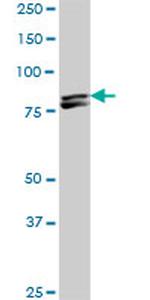 MTA1 Antibody in Western Blot (WB)