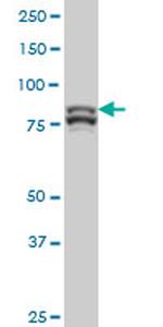 MTA1 Antibody in Western Blot (WB)