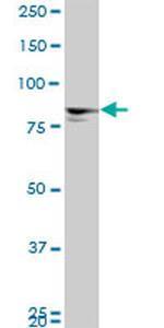 MTA1 Antibody in Western Blot (WB)