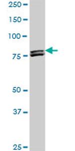 MTA1 Antibody in Western Blot (WB)