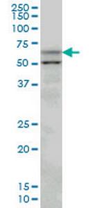 SLC33A1 Antibody in Western Blot (WB)