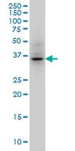 AURKB Antibody in Western Blot (WB)