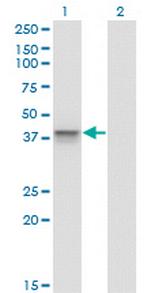 AURKB Antibody in Western Blot (WB)