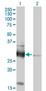 VAPB Antibody in Western Blot (WB)