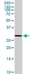 VAPB Antibody in Western Blot (WB)