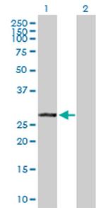 VAPB Antibody in Western Blot (WB)