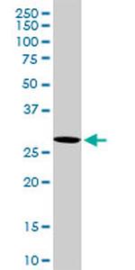 VAPB Antibody in Western Blot (WB)