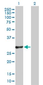 VAPB Antibody in Western Blot (WB)