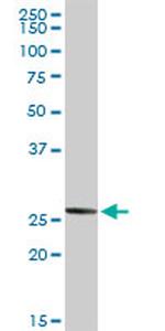 NOG Antibody in Western Blot (WB)