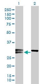 NOG Antibody in Western Blot (WB)