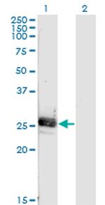 NOG Antibody in Western Blot (WB)