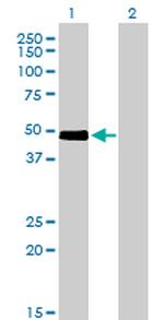 CRLF1 Antibody in Western Blot (WB)