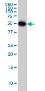 CRLF1 Antibody in Western Blot (WB)